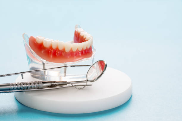 Dental Bonding in Town And Country, WA